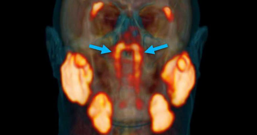 人體其實還有很多秘密，亟待醫生及專家們發現。（圖／翻攝自sciencedirect.com）