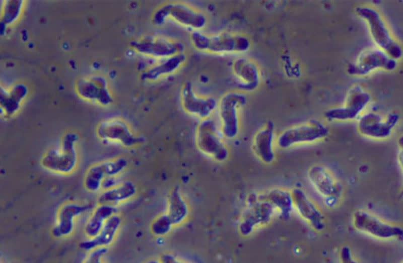 福氏內格里阿米巴原蟲，俗稱食腦變形蟲（Naegleria Fowleri）。（圖／翻攝自美國CDC）