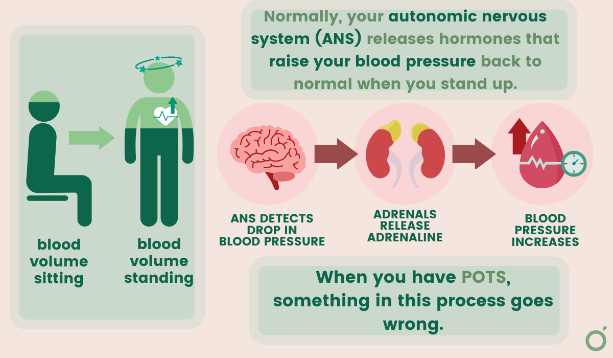 graphic showing what goes wrong in POTS