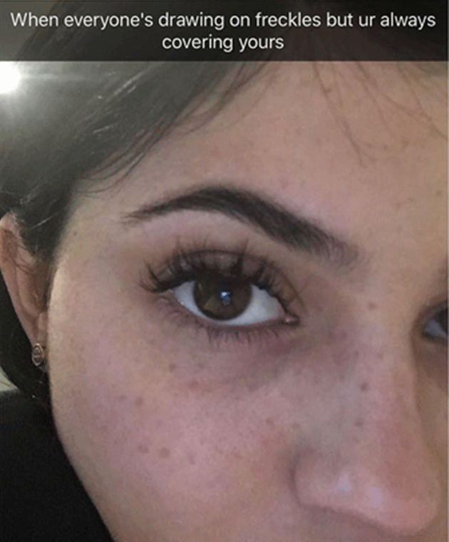 Kylie Jenner shared this freckly photo on Snapchat. Photo: Snapchat