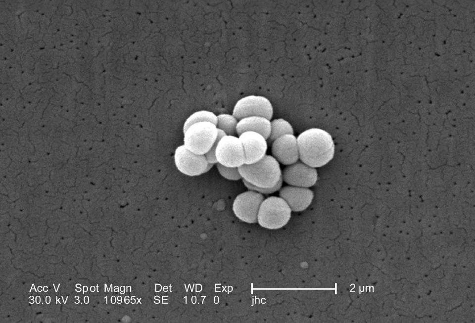 Una foto proporcionada por Janice Haney Carr / Centros para el Control y la Prevención de Enfermedades (CDC, por su sigla en inglés) muestra al Micrococcus luteus, que produce el olor corporal, ampliado 10.000 veces. (Janice Haney Carr / CDC vía The New York Times).