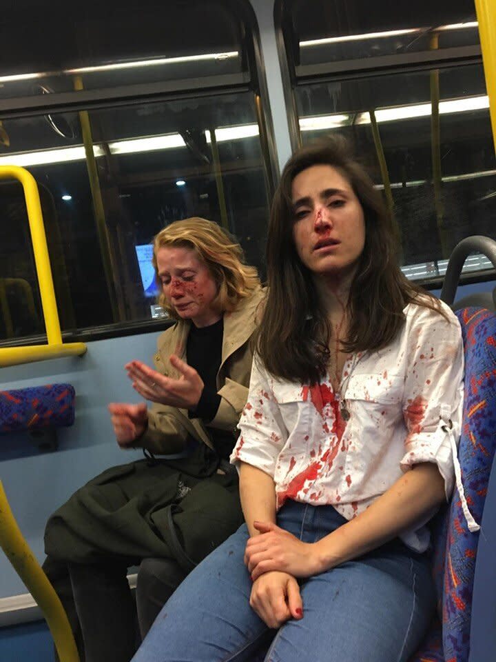 Melania Geymonat shared this photo of her and her date following the May 30 assault on a London bus. Four teenagers have since been charged in the attack. (Photo: Facebook)