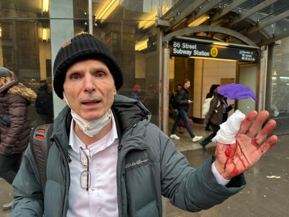 A 61-year-old victim was left bloodied by an attack with an umbrella at the 86th Street station on the Upper East Side. Peter Gerber