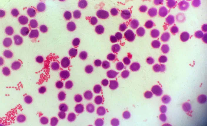 Bacteria (clusters of light pink, surrounded by larger magenta blood cells) can cause deadly infections, but overreactive immune responses can deliver the lethal blow. <a href=