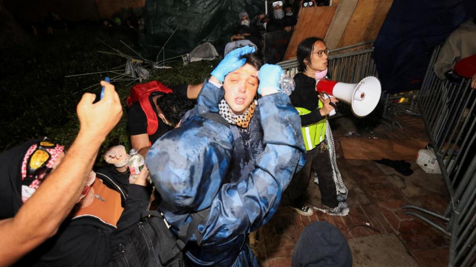 PHOTO: A pro-Palestinian protester receives help getting pepper spray rinsed off amid clashes with counter-protesters, at an encampment on the UCLA campus, May 1, 2024, in Los Angeles.  (David Swanson/Reuters)