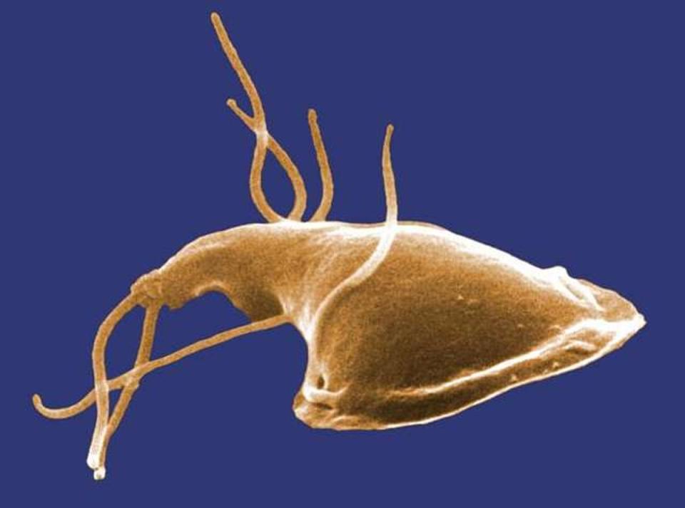 A close-up of the Giardia parasite, which causes Giardiasis (Wikicommons)