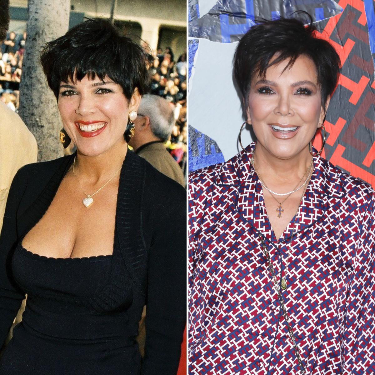 Plastic Surgery? See Kris Jenner’s Transformation and Quotes About