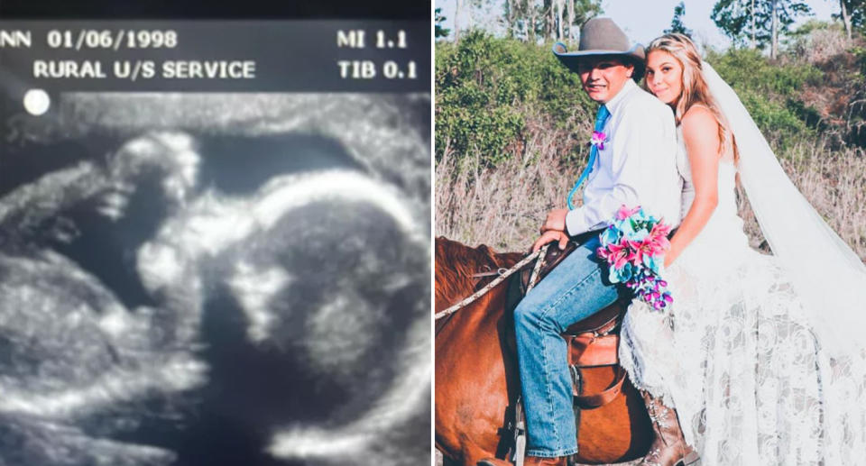 Plane crash victims Rhiley Kuhrt, and his wife Maree on their wedding day and ,left, a scan of their unborn child.