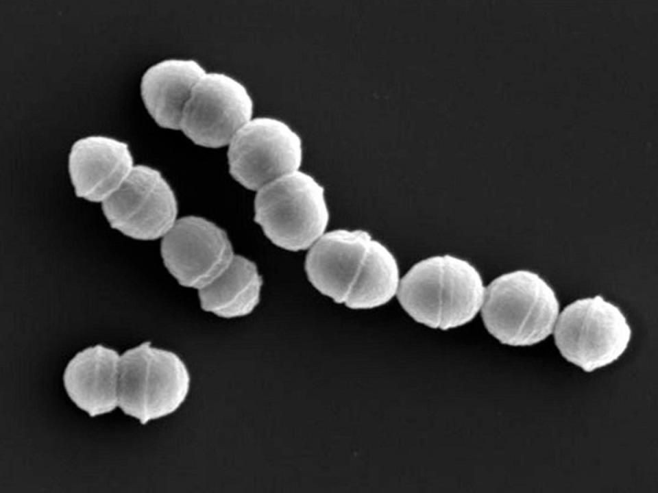 Group A streptococcus (National Institute of Infectious Diseases)