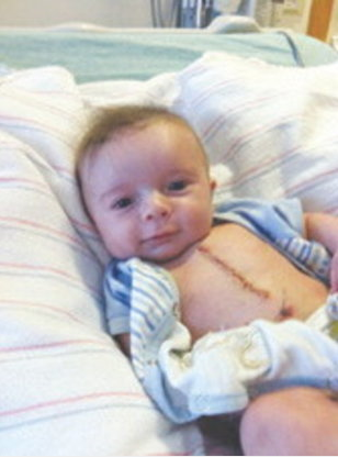 <div class="caption-credit"> Photo by: Sarah Powling/Lowell Sun</div><b>The ridiculously good-looking surgery baby</b>: At three-months-old, Joey Powling Jr. had open-heart surgery to save his life. Born with a rare congenital condition, Powling underwent a grueling operation that left him with a scar from his neck to his lower rib cage. His reaction: It's all good. After his mom snapped this photo of her Powling in recovery--smirking like Bruce Willis at the end of a "DieHard" movie--<a href="http://yhoo.it/Wxy7zZ" rel="nofollow noopener" target="_blank" data-ylk="slk:the image went viral;elm:context_link;itc:0;sec:content-canvas" class="link ">the image went viral</a> and turned this tiny survivor into a meme-worthy superhero. <br>