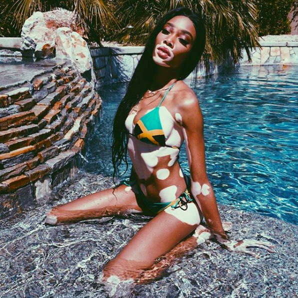 <p>Model Winnie Harlow hit the pool while at Coachella 2018 in a two-piece bikini. <em>[Photo: Instagram]</em> </p>