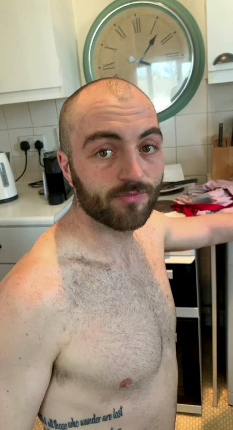 The builder was forced to shave it all off (SWNS)