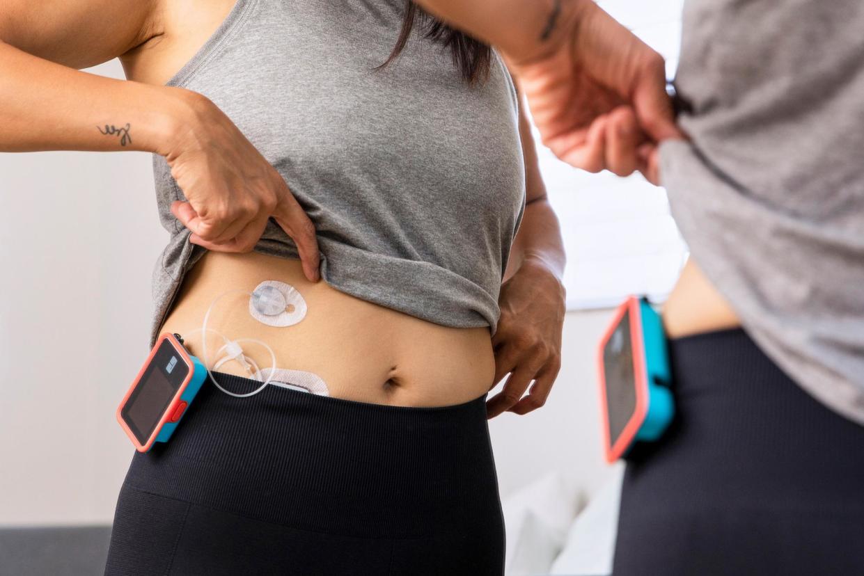<span>CGMs tout an edge in personal health optimization, but are they just the latest trend among the worried well?</span><span>Photograph: Matt Harbicht/Getty Images for Tandem Diabetes Care</span>