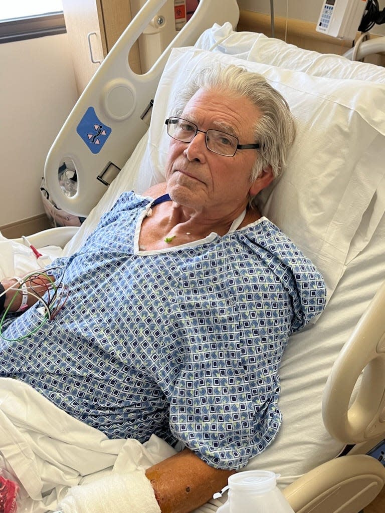 Cape Coral disabled veteran and retired director of community funding for WGCU Terry Brennen is in Cape Coral Hospital fighting Vibrio vulnificus.