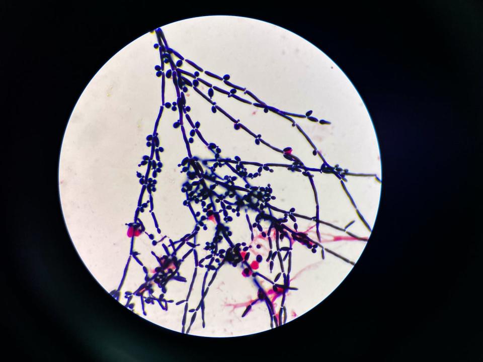 This microscopy image shows budding yeast cells. <a href="https://www.gettyimages.com/detail/photo/budding-yeast-cell-in-gram-stain-royalty-free-image/1464904014" rel="nofollow noopener" target="_blank" data-ylk="slk:toeytoey2530/iStock via Getty Images Plus;elm:context_link;itc:0;sec:content-canvas" class="link ">toeytoey2530/iStock via Getty Images Plus</a>