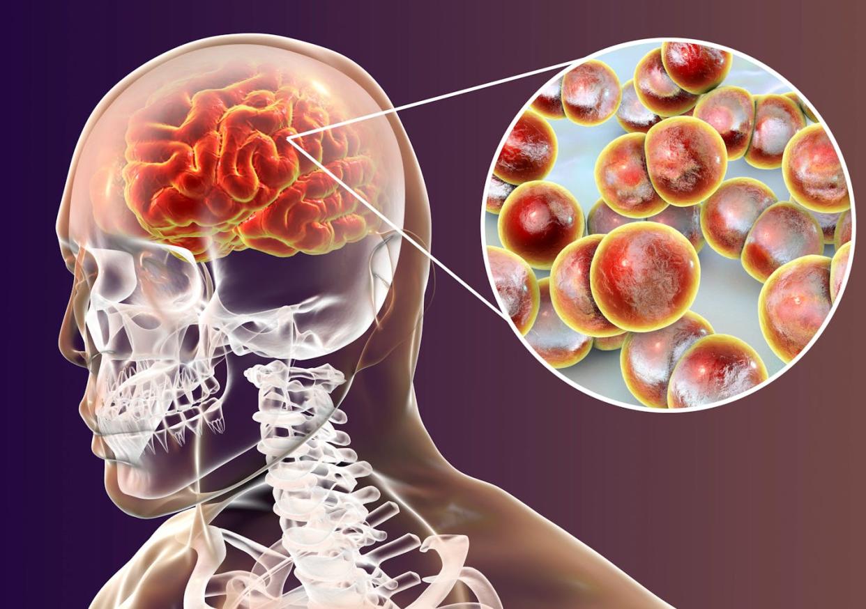 Infección cerebral de Neisseria meningitidis, bacteria causante de la meningitis. <a href="https://www.shutterstock.com/es/image-illustration/brain-infection-neisseria-meningitidis-bacteria-3d-1084673081" rel="nofollow noopener" target="_blank" data-ylk="slk:Kateryna Kon/Shutterstock;elm:context_link;itc:0;sec:content-canvas" class="link ">Kateryna Kon/Shutterstock</a>