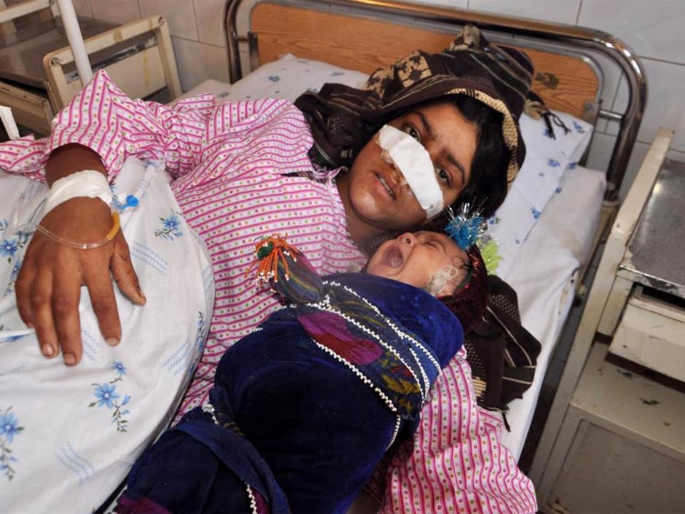 Reza Gul, whose nose was sliced off by her husband, lies on a bed with her baby as she receives treatment at a hospital in the northern province of Faryab (AFP/Getty Images)