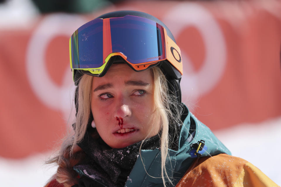 <p>Die australische Snowboarderin Emily Arthur stürzte während des Finales in der Halfpipe auf ihr Gesicht und musste ärztlich versorgt werden.<br> (Bild: Reuters/Mike Blake) </p>