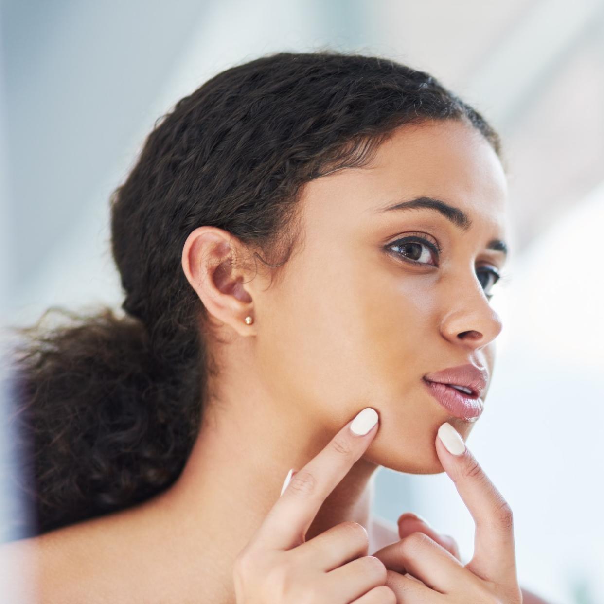  girl popping her pimple 