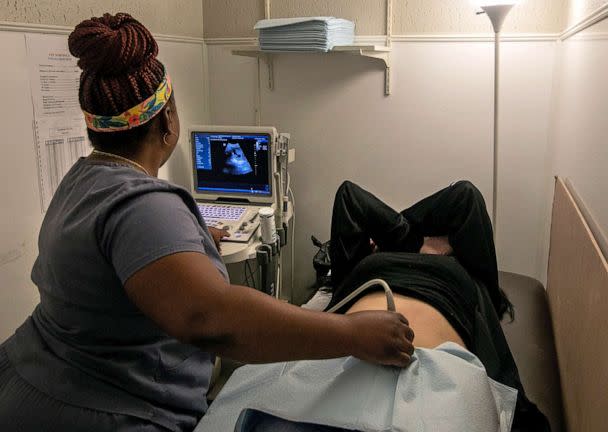 PHOTO: An operating room technician performs an ultrasound on a patient at Hope Medical Group for Women in Shreveport, La., on July 6, 2022. (Ted Jackson/AP, FILE)