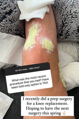 <p>Lindsey Vonn/Instagram</p> Lindsey Vonn shares an image of her knee