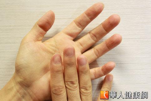 邱品齊醫師建議，媽媽們做家事務必養成戴手套的習慣，事後再搭配護手霜保養，且擦之前要先沾點水，才是正確的保養法。（攝影／黃志文）