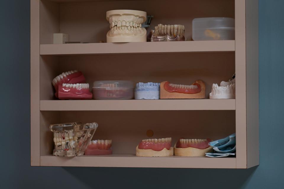 Model teeth sit on a display Monday, August 21, 2023, at West Main Family Dental in Richmond, Ind.