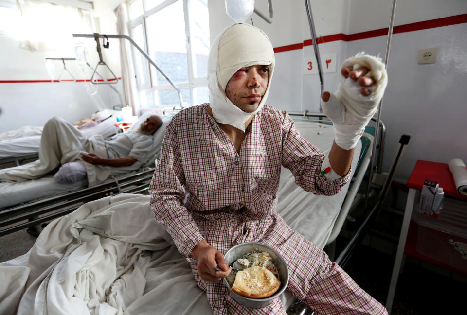 FILE - In this Jan. 21, 2016 file photo, an employee of Tolo TV, owned by the private Moby Group, who was wounded in a Taliban suicide attack on their minibus, recovers in a hospital, in Kabul, Afghanistan. As the world watches intently for clues on how the Taliban will govern, their treatment of the media will be a key indicator, along with their policies toward women. (AP Photos/Rahmat Gul, File)