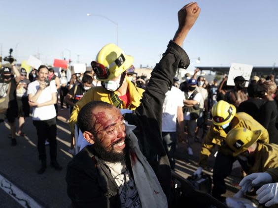 Man helped by fire department following protest in Los Angeles (Arnaud Andrieu / SIPA / REX)