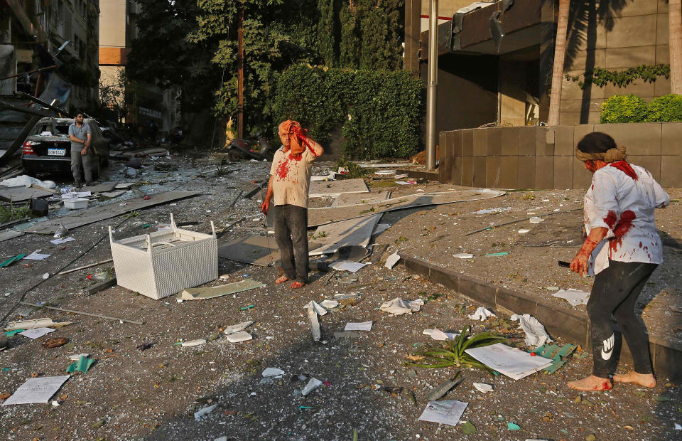 Wounded people walk through the debris in the heart of Beirut following a twin explosion that shook the capital on August 4, 2020. | Marwan Tahtah—AFP via Getty Images