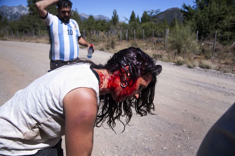 Celeste Fierro, dirigente del MST, sufrió heridas cortantes en la cabeza