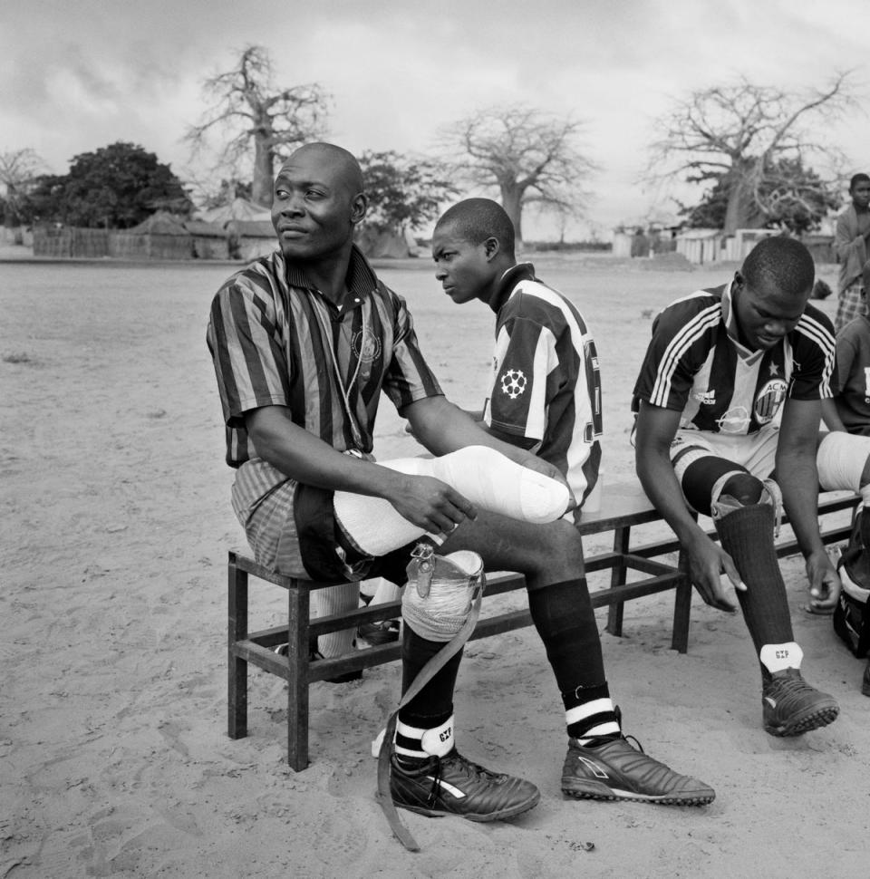 An amputee straps on his prosthetic limb before taking to the field during a friendly football match at a war veterans camp situated on the outskirts of Luanda. Luanda, Angola. June 2002 (TIM A HETHERINGTON)