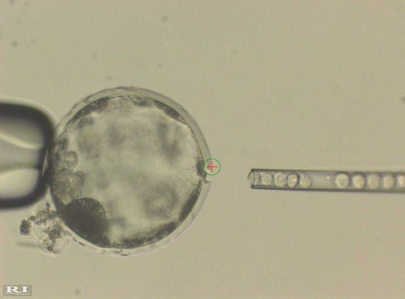 Human stem cells are injected into the pig embryo (Salk Institute)