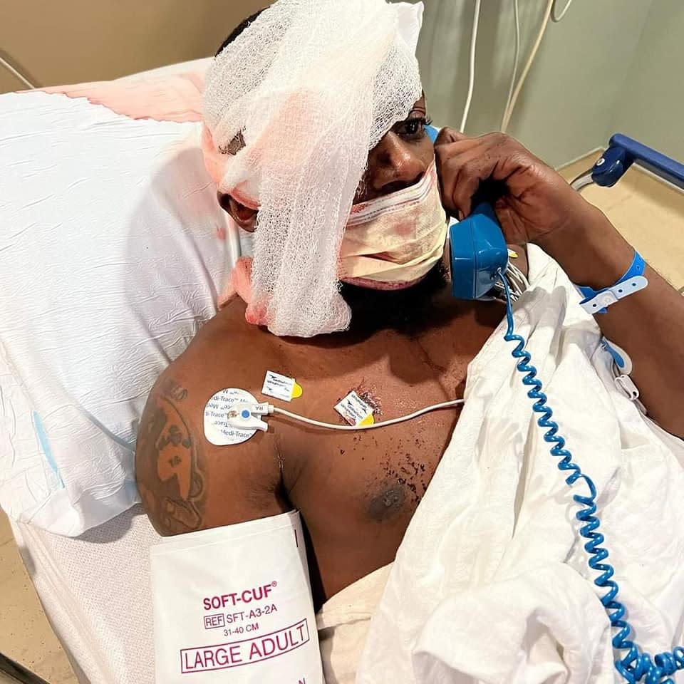Gainesville resident Terrell Bradley, 30, sits in a hospital bed after losing his right eye from a K-9 attack after he ran from the police. [Submitted]