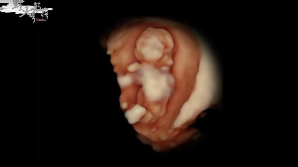 KID分享胎兒影片。（圖／翻攝自野人七號部落YouTube）