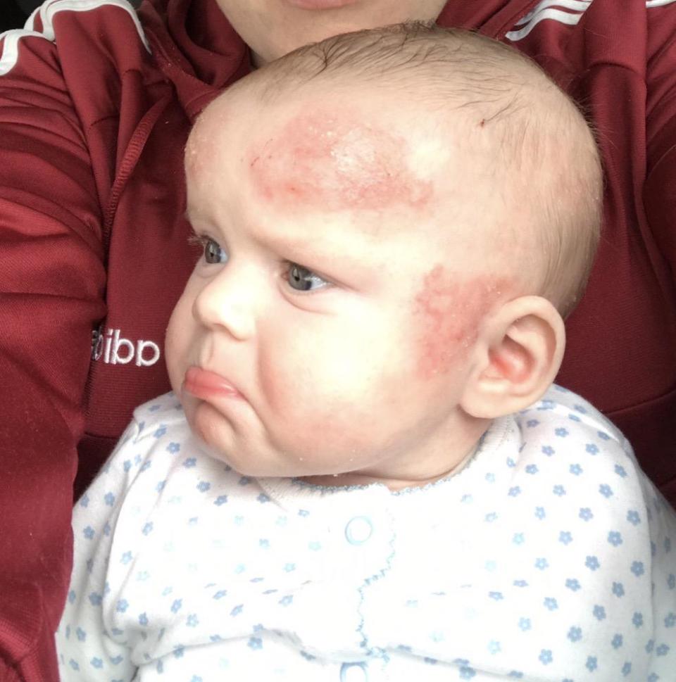 Nevin would receive unwanted looks from strangers when they spotted Kelisha's skin condition in public (Childs Farm)