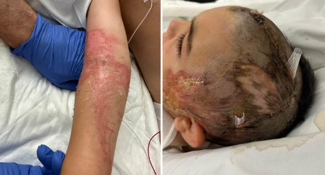 Woman has SCALP ripped off after hair got trapped in machine during  horrific farm accident