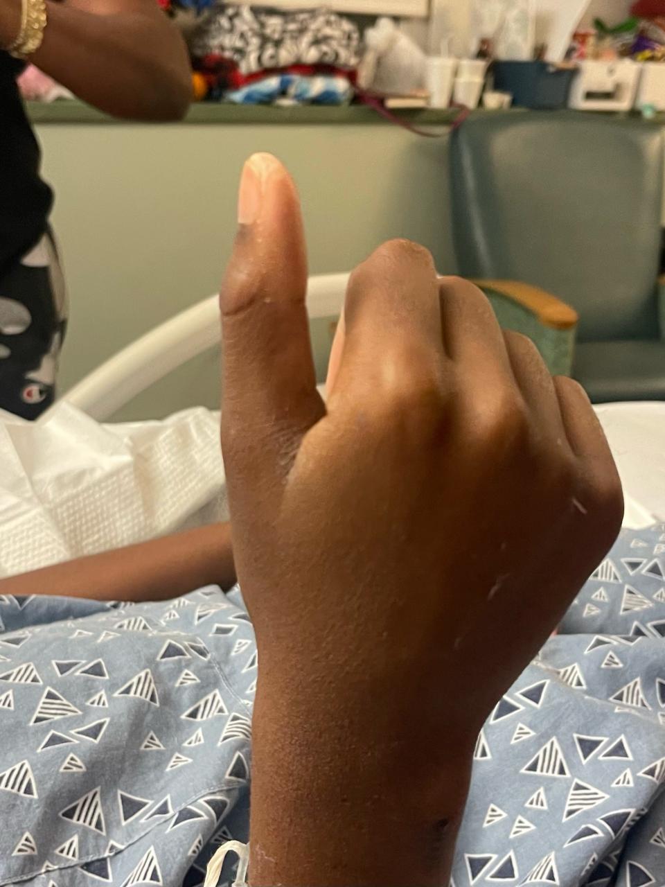 Kamauri Curry, an eighth grader, offers a thumbs up from his hospital bed. He was one of three survivors in a shooting that left three dead at a Palm Bay apartment complex.