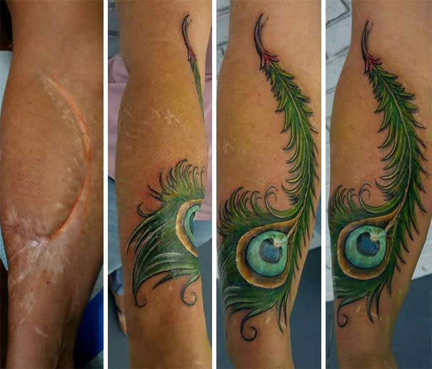 Tatuajes sobre cicatrices