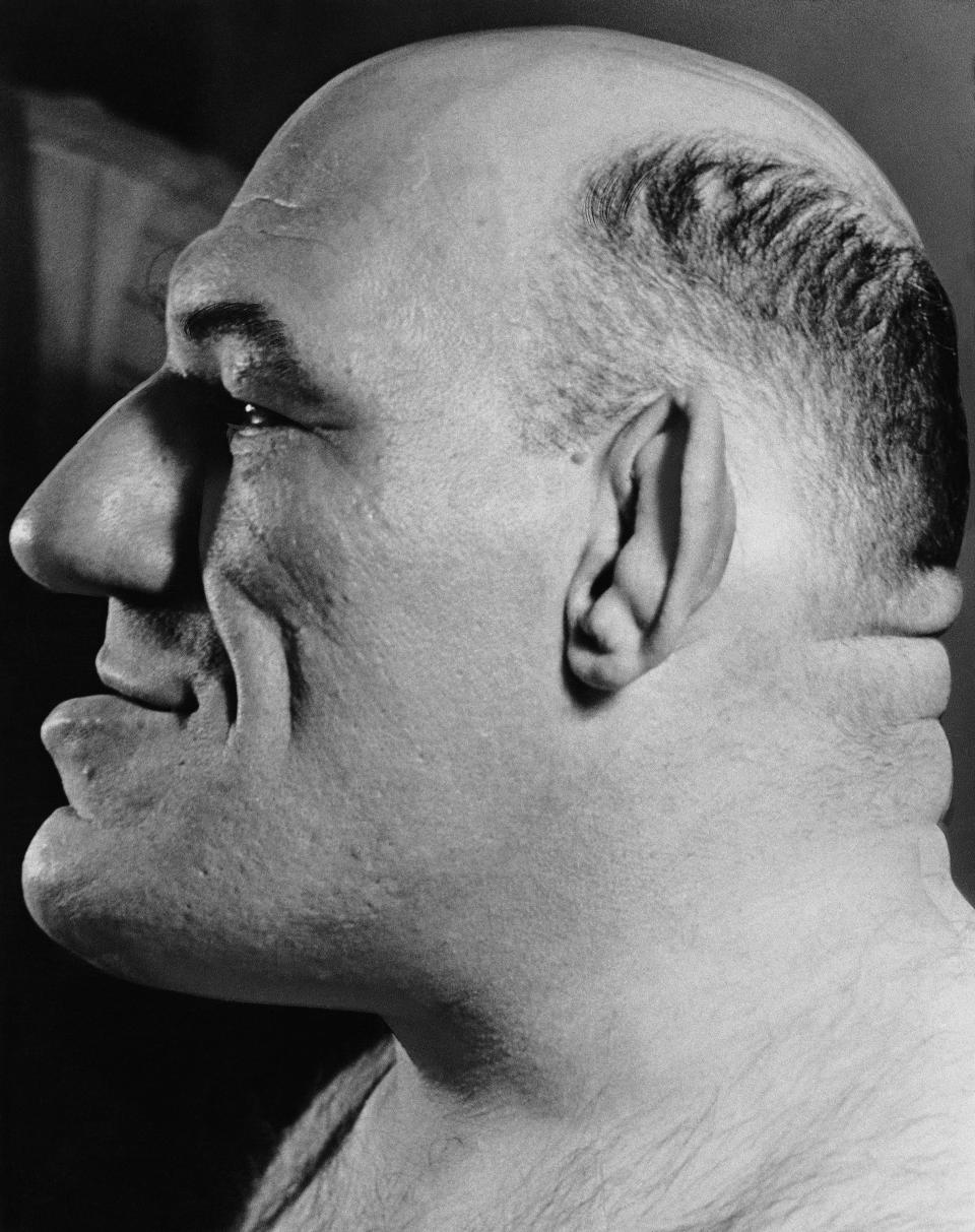 Maurice Tillet