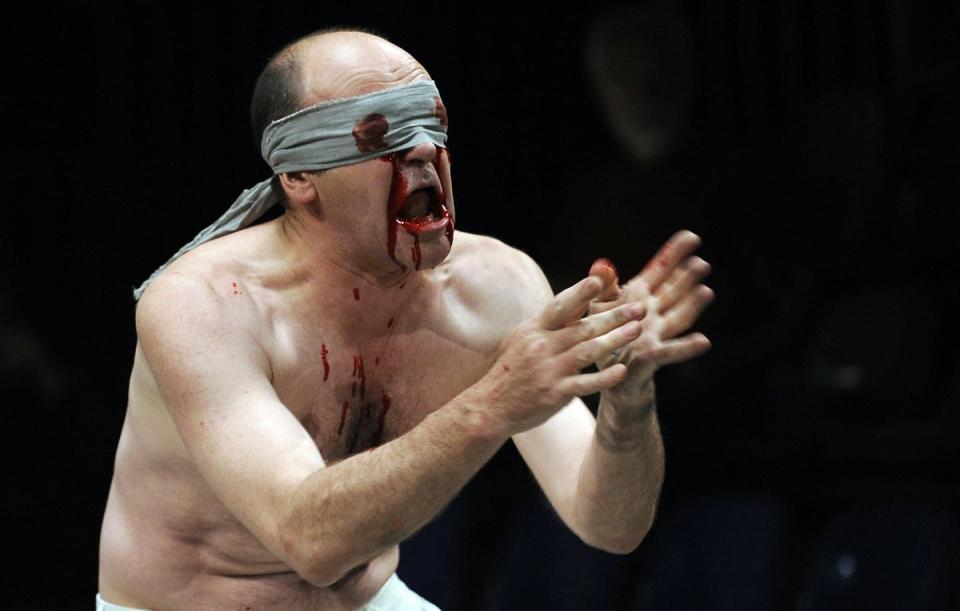 When Oedipus learns he killed his father and married his mother, he gouges out his eyes in shame, as depicted in this theatrical play presented at the 63rd Avignon International Theatre festival in France in 2009. <a href="https://www.gettyimages.com/detail/news-photo/french-jacques-bonnaffe-as-oedipe-performs-a-scene-of-the-news-photo/88979287?phrase=Oedipus&adppopup=true" rel="nofollow noopener" target="_blank" data-ylk="slk:Anne-Christine Poujoulat/AFP via Getty Images;elm:context_link;itc:0;sec:content-canvas" class="link ">Anne-Christine Poujoulat/AFP via Getty Images</a>