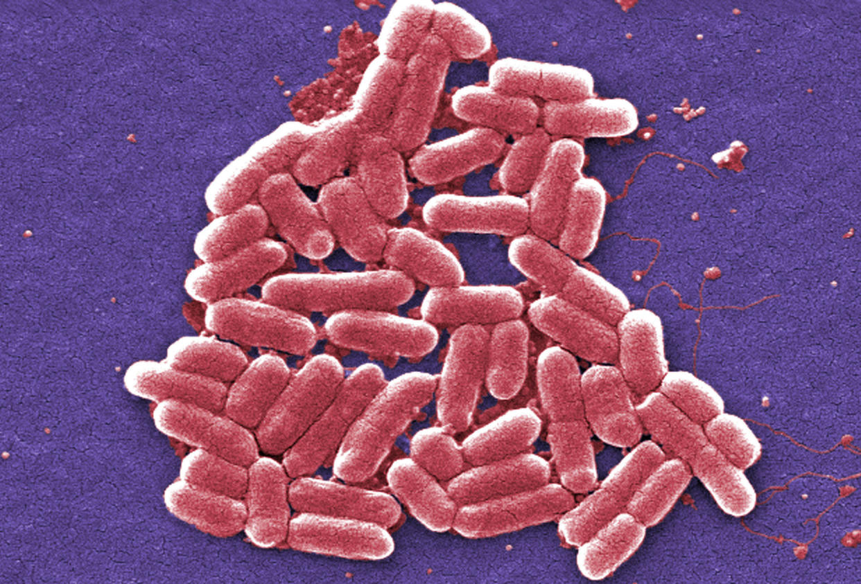 A colorized scanning electron micrograph image made available by the Centers for Disease Control and Prevention shows the O157:H7 strain of the E. coli bacteria. (Photo: Janice Carr/CDC via AP)