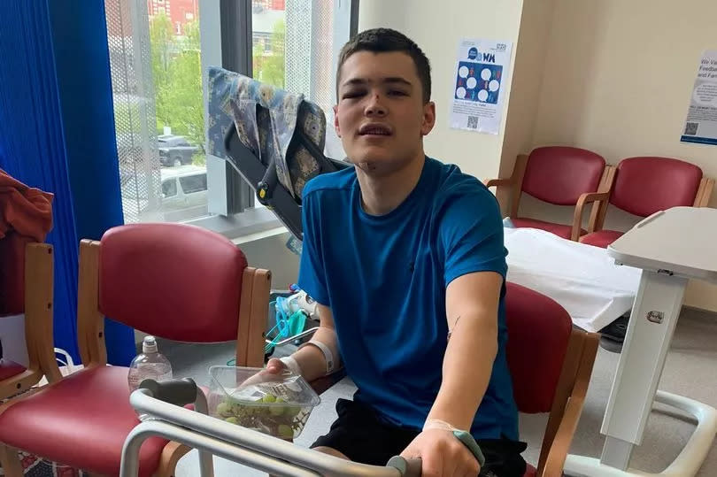 Onur, 14, fell during the FA Cup Semi-Final (20 April)