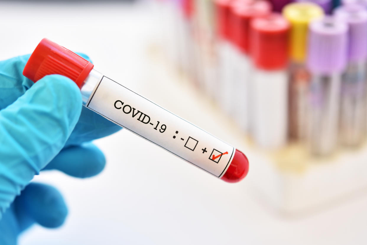 Blood sample tube positive with COVID-19 or novel coronavirus 2019 found in Wuhan, China