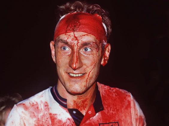 Terry Butcher was left covered in blood during England's match against Sweden in 1989 (Rex)