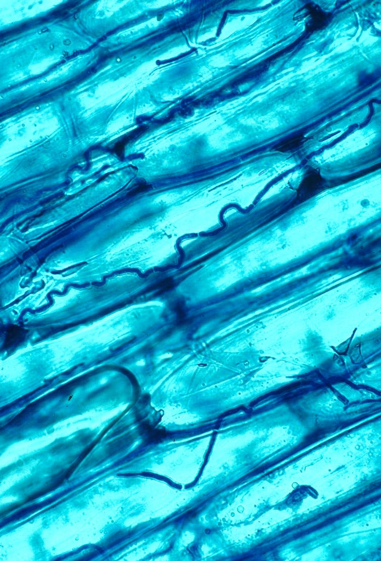 <span class="caption">The fungal endophyte <em>Epichloe coenophiala</em> growing in between grass leaf cells.</span> <span class="attribution"><span class="source">Nick Hill/USDA</span></span>