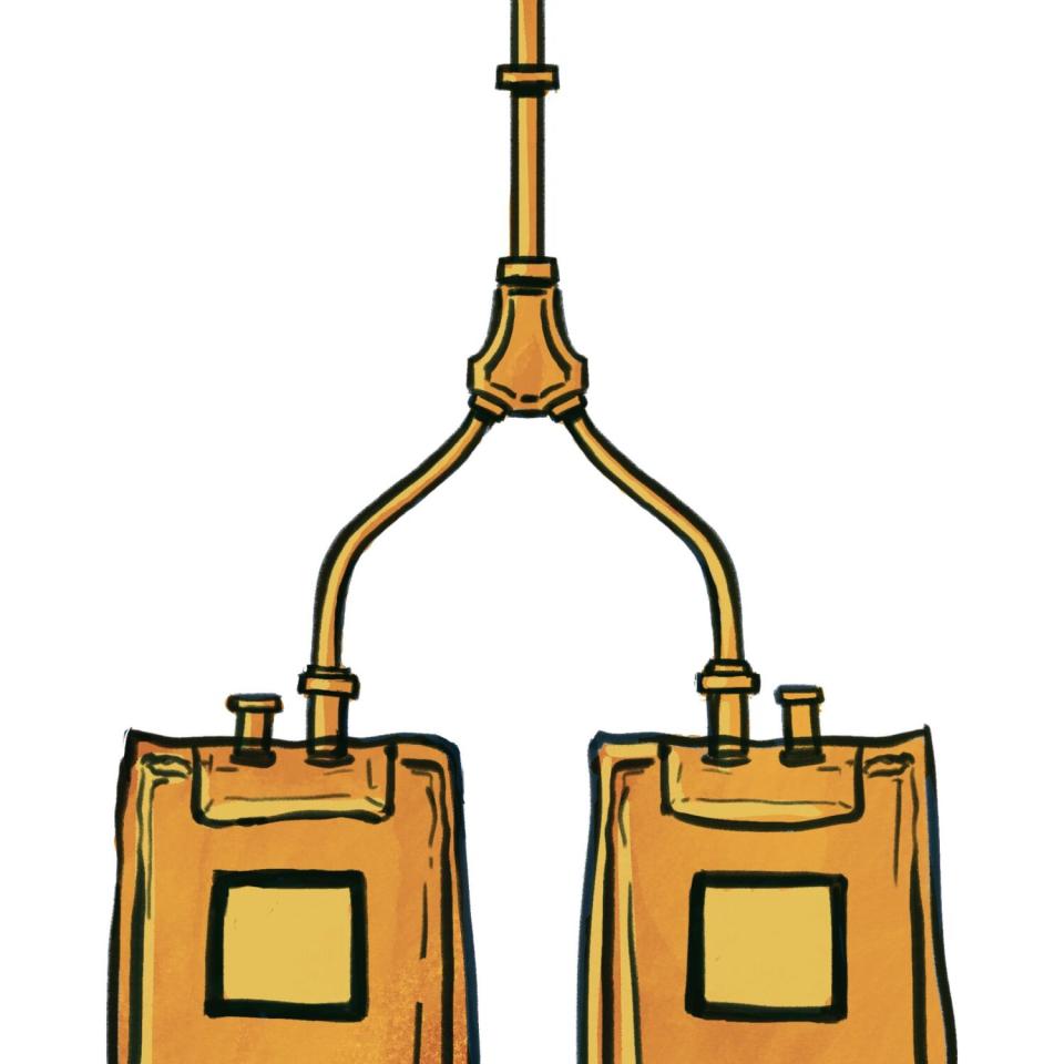 illustration of kidney dialysis tubing attached to boxes