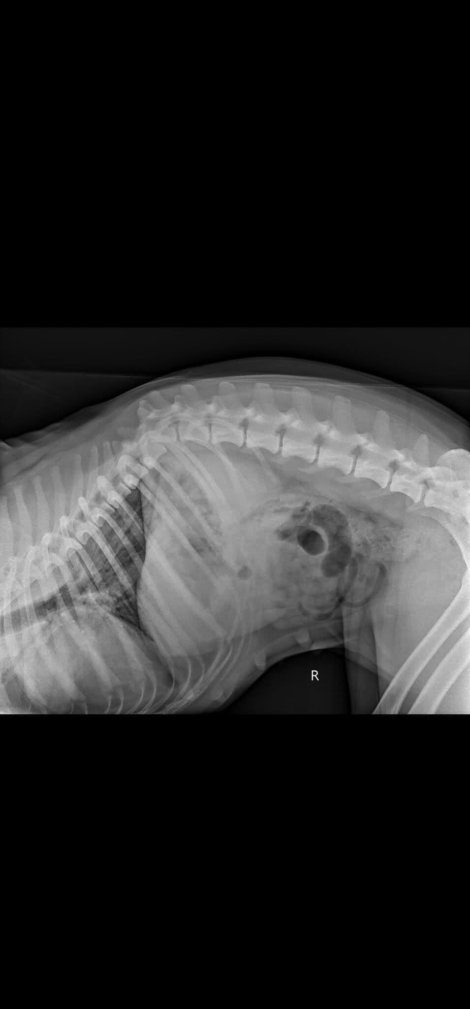 An X-ray image shows the damage to Cooper's spine.