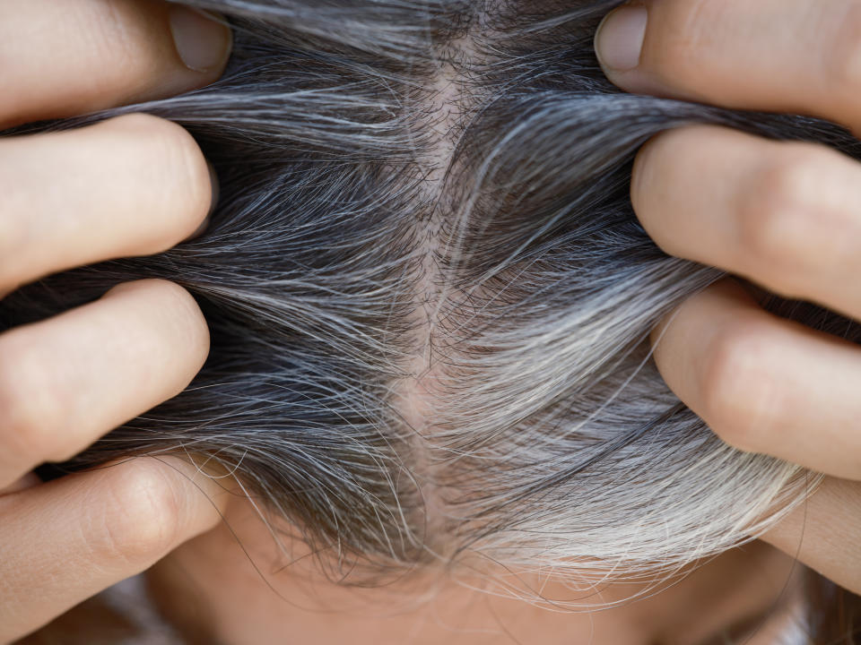 A person showing the gray roots of their hair