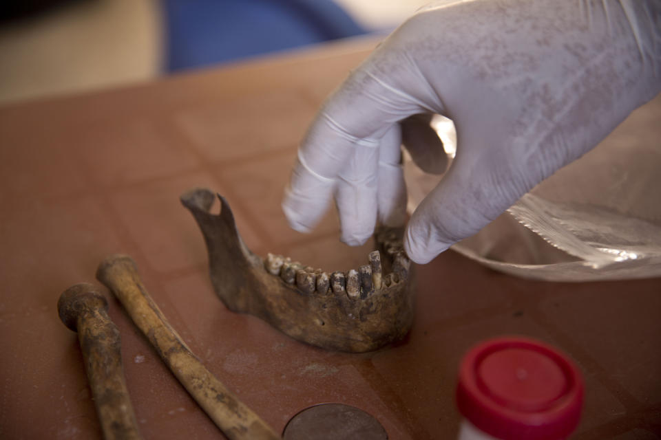 In this Saturday, Sept. 7, 2019 photo, a human lower jaw that was found in a mass grave is kept for identification, in Raqqa, Syria. First responders said they have pulled nearly 20 bodies out of the latest mass grave uncovered in Raqqa, the Syrian city that was the de facto capital of the Islamic State group. It is the 16th mass grave in the city, and officials are struggling with a lack of resources needed to document and one day identify the thousands of dead who have been dug out. (AP Photo/Maya Alleruzzo)